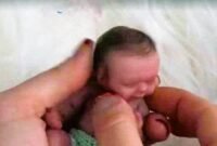 Amelia Taylor bayi terkecil didunia yang dapat disimpan dalam cangkang telur ayam.(ist)
