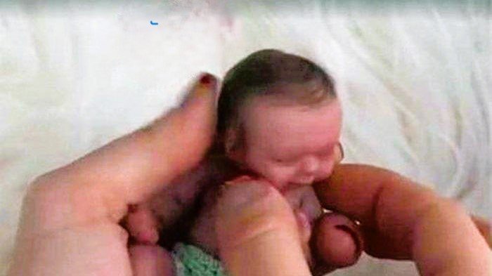 Amelia Taylor bayi terkecil didunia yang dapat disimpan dalam cangkang telur ayam.(ist)