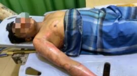 Korban yang merupakan pengurus Ponpes An Nur di Kecamatan Hinai alami luka bakar yang disebabkan oleh teman dekatnya, Sabtu (05/10)