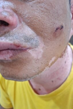 Usai Jadi Tersangka, Ayah-Anak di Langkat Diduga Maikan Opini, Kuasa Hukum Korban : Itu Playing Victim