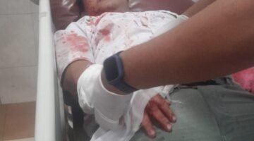 Pelajar Dibegal Sadis di Binjai, Tangan Korban Nyaris Putus Dibacok